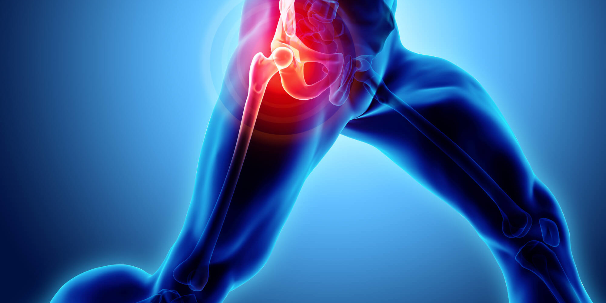 Living with Hip Pain &amp; How Jax Spine &amp; Pain Centers Can Help! - Jax Spine &amp; Pain Centers