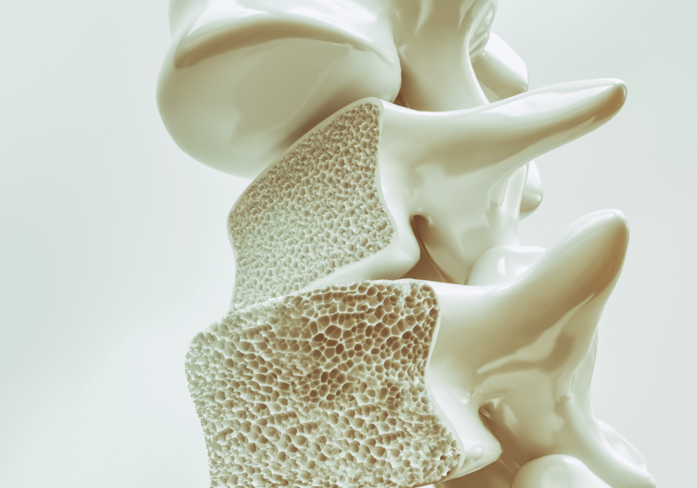 what is osteoporosis